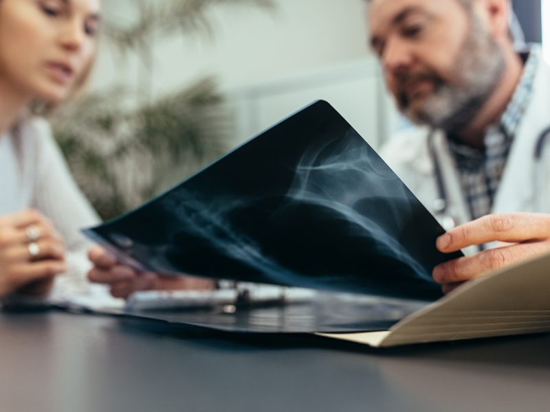 Dokter bespreekt röntgenfoto met patiënt